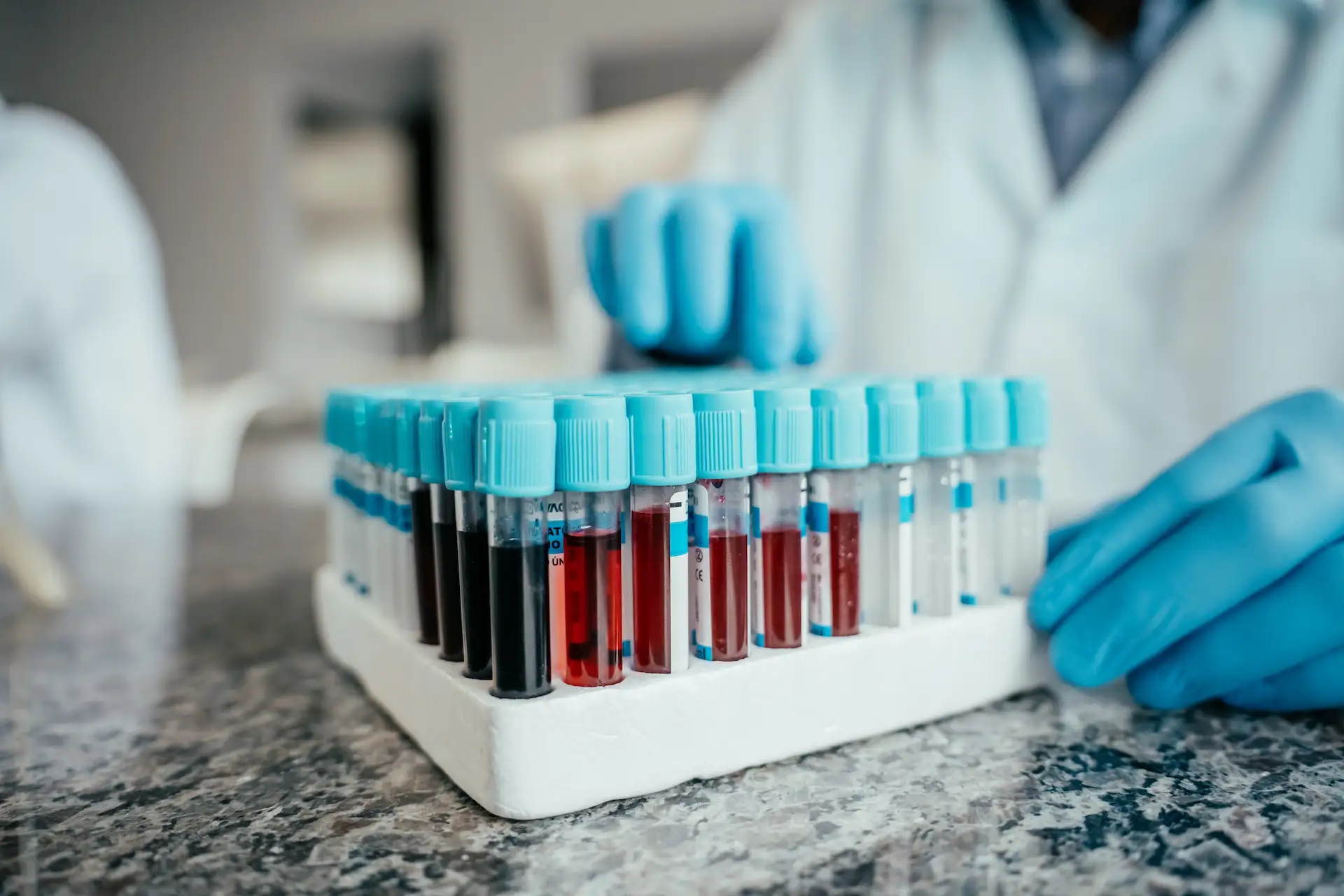 Close-up of lab technician with blue gloves reaching for test tube