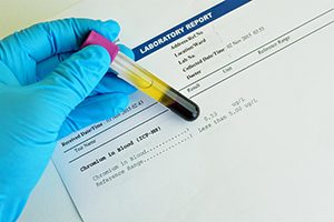 Heavy Metal Blood Test