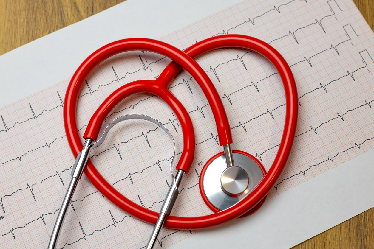 Stethoscope resting on top of electrocardiogram paper